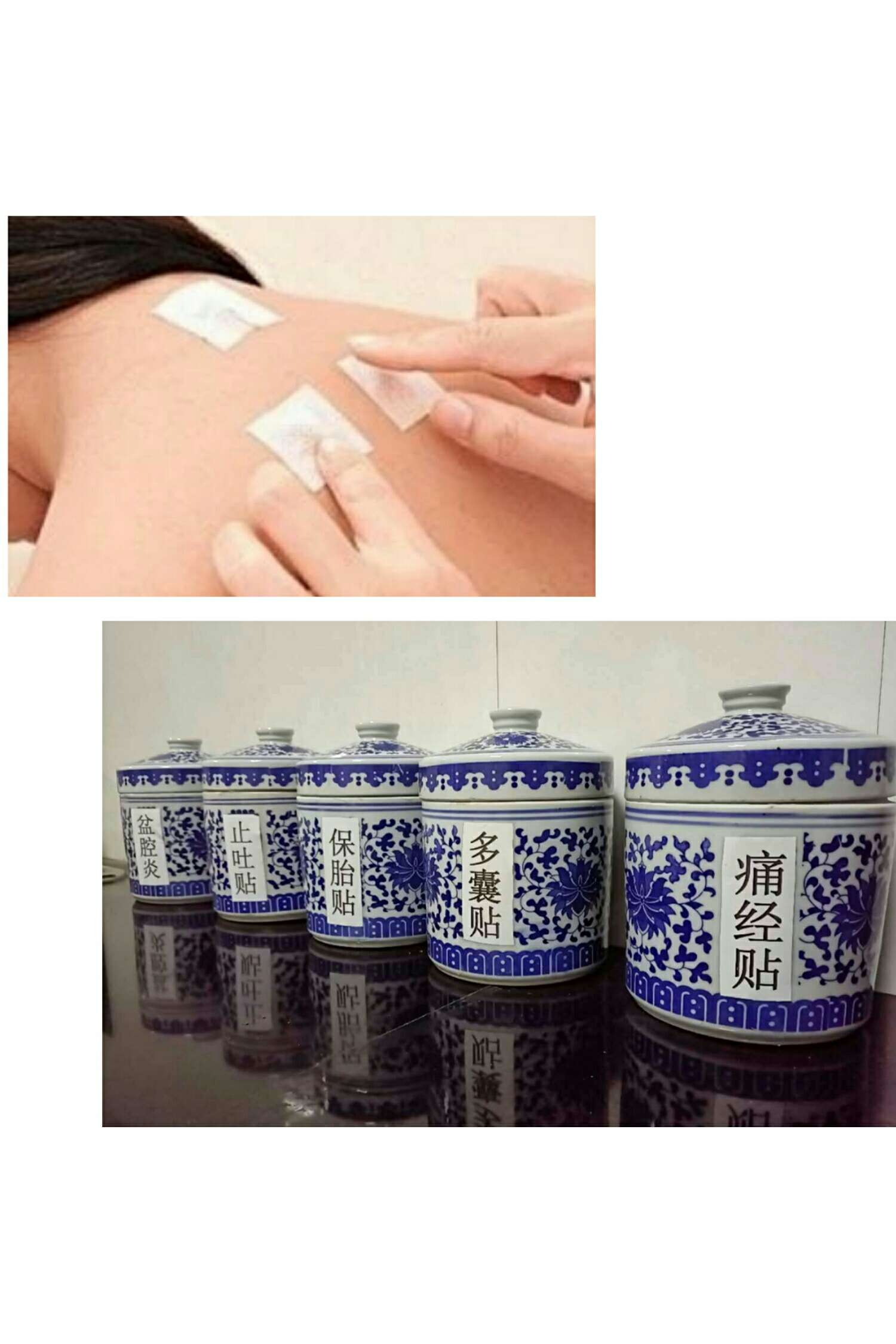 1、三伏貼能治什么??？