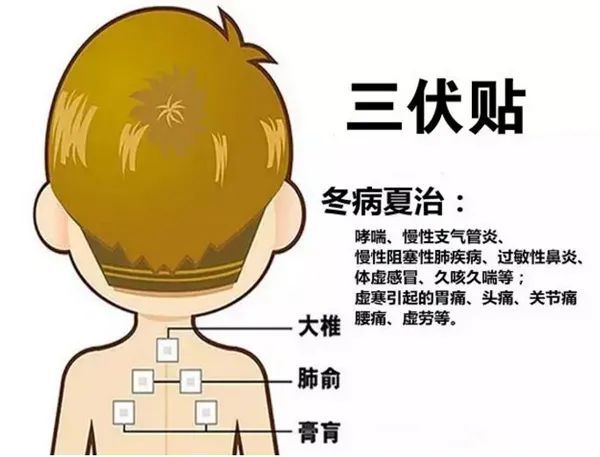 2、三伏貼的功能和功效是什么？
