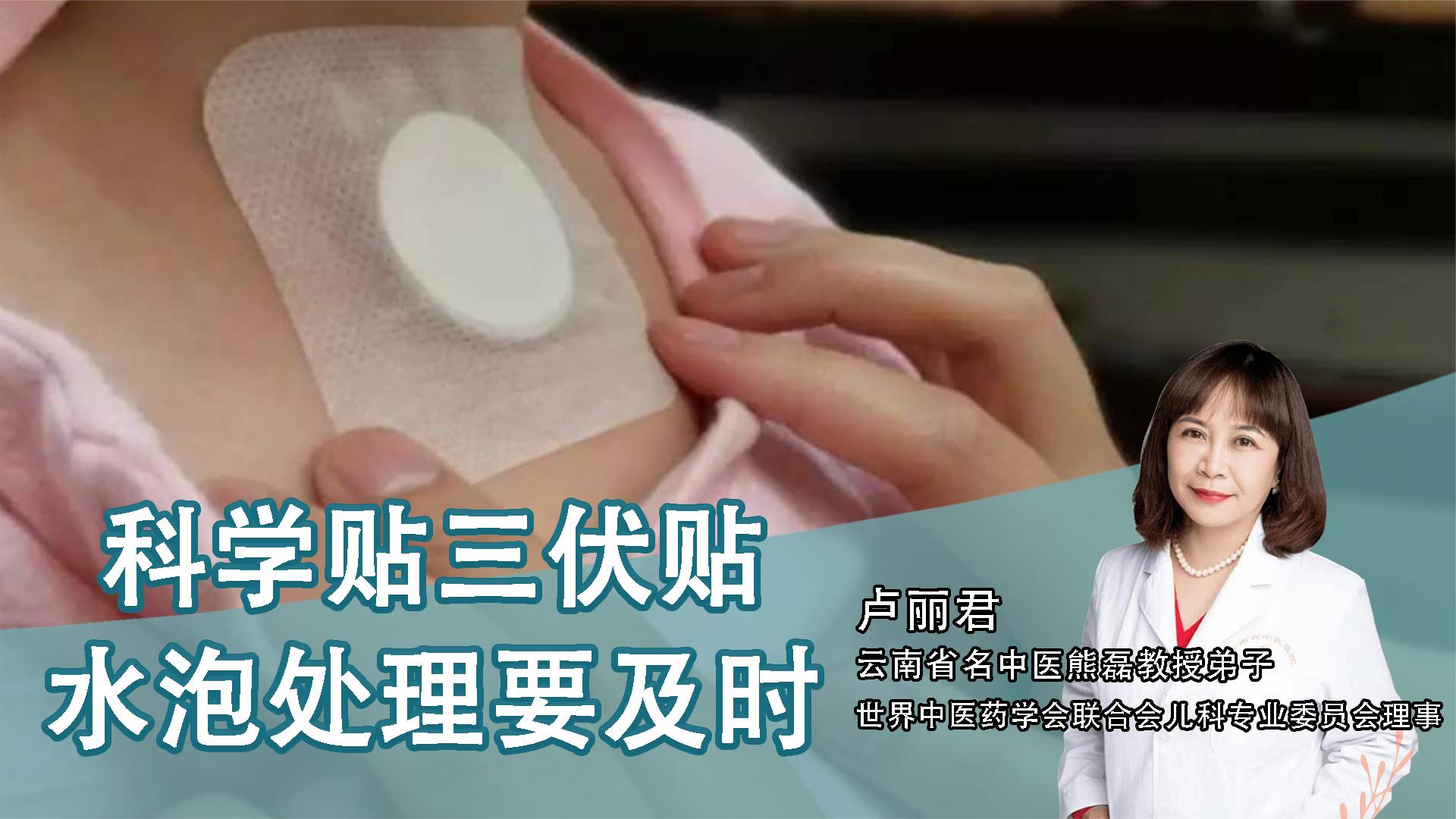 2、貼三伏貼后有什么禁忌？