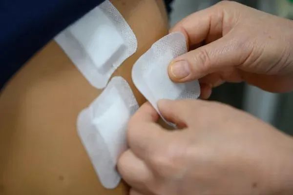 1、三伏貼過敏能擦藥嗎？