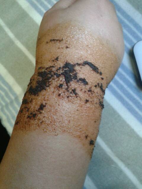 4、貼了兩個星期的膏藥。突然長了很多紅癢的疙瘩。原因是什么？還能繼續貼嗎？